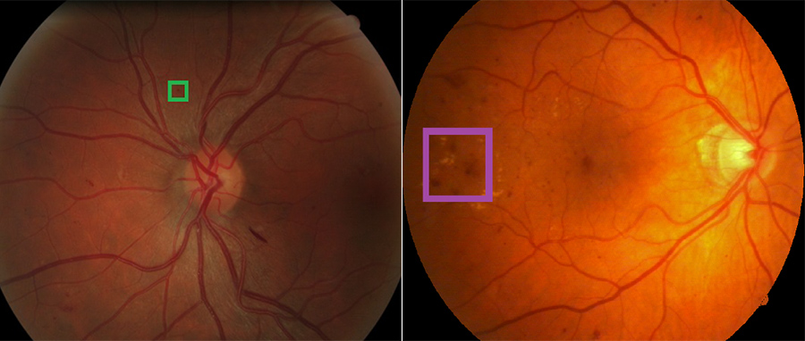 Image of two retinas being compared
